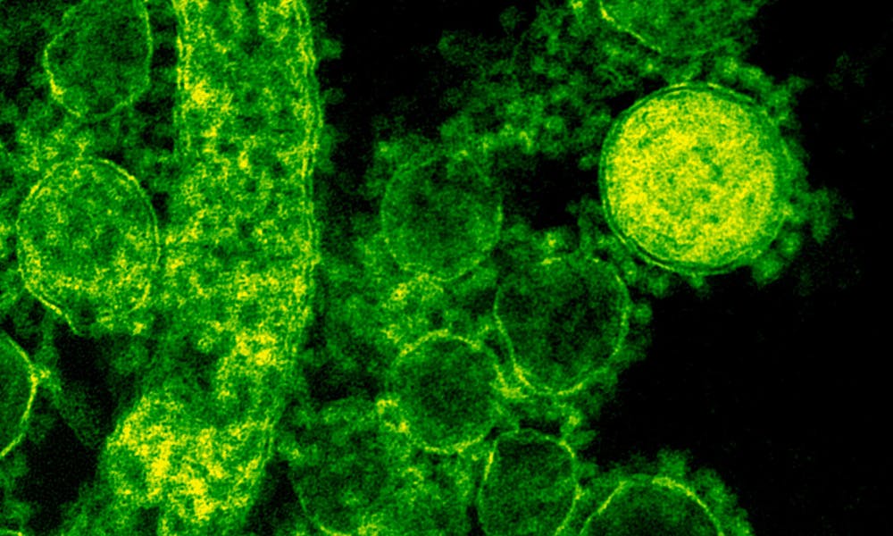 Green-tinted microscopic image of coronavirus particles illustrating viral structures. .pexels